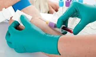 About the blood from the elbow vein