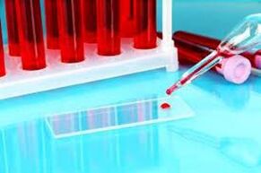 Hemoscania of blood drops for parasites