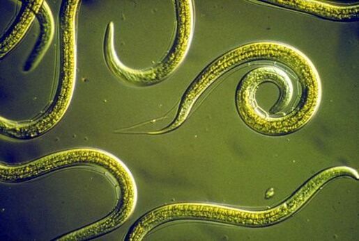 Parasitic nematode worms that live in the human small intestine