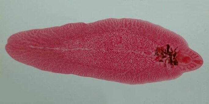 worm worm in humans