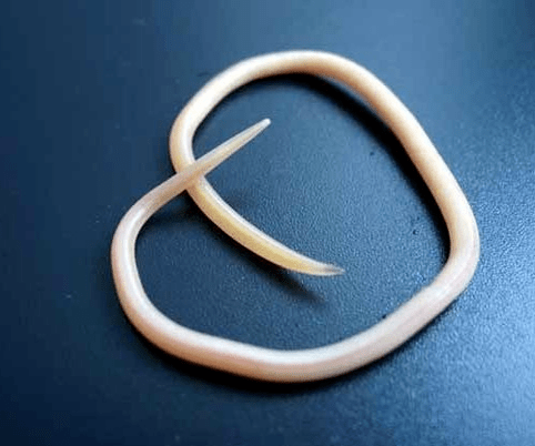 how are roundworms
