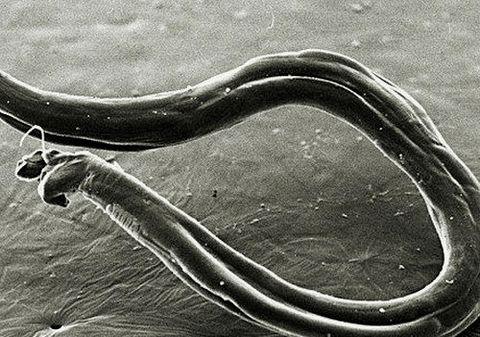 how hookworms look in the human body