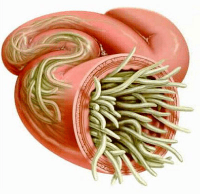 roundworm in the human intestine