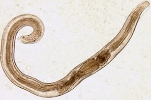 worms in the human body